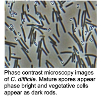 Phase contrast microscopy images of C. difficile. Mature spores appear phase bright and vegetative cells appear as dark rods