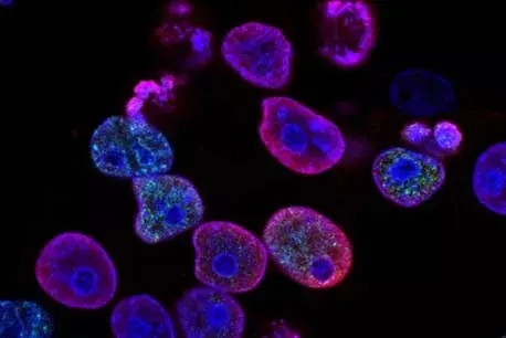 OK-1 cancer photo