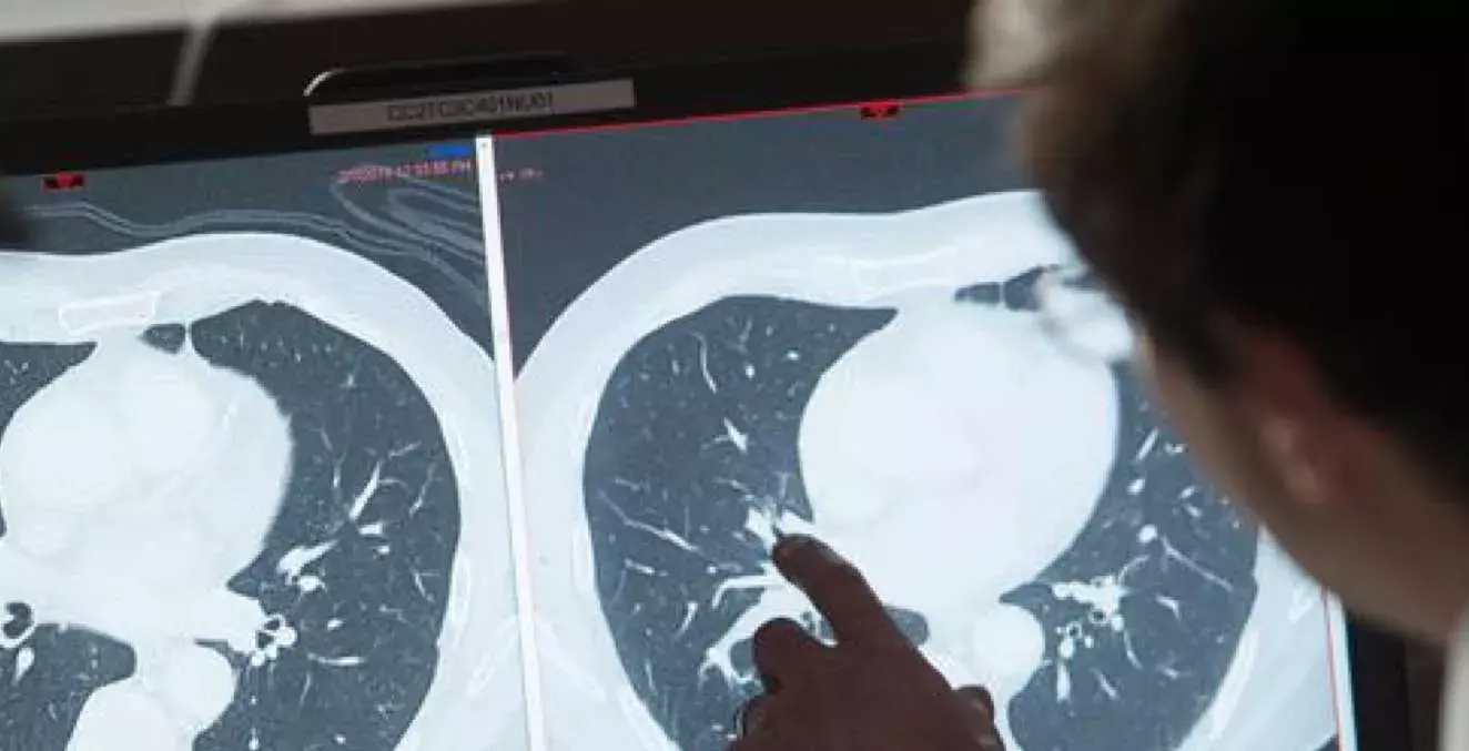Person looking at scans