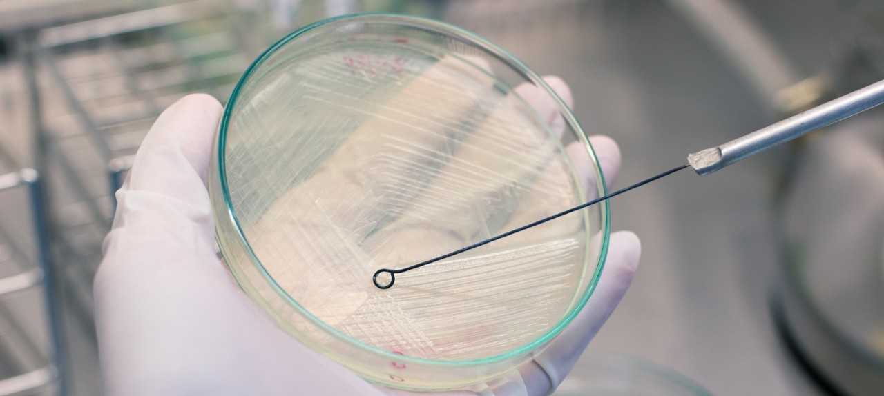 hand holding petri dish