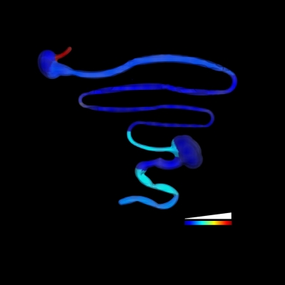 A plot of how the esophagus stays perturbed even after Trypanosoma cruzi parasite levels decrease